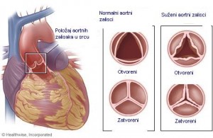 AORTA