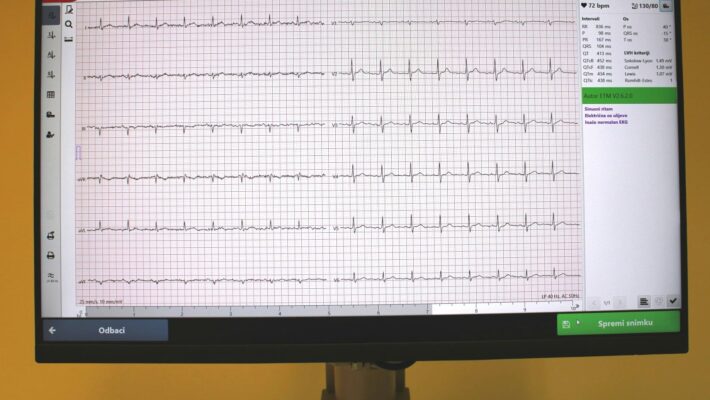 Elektrokardiografija (EKG)